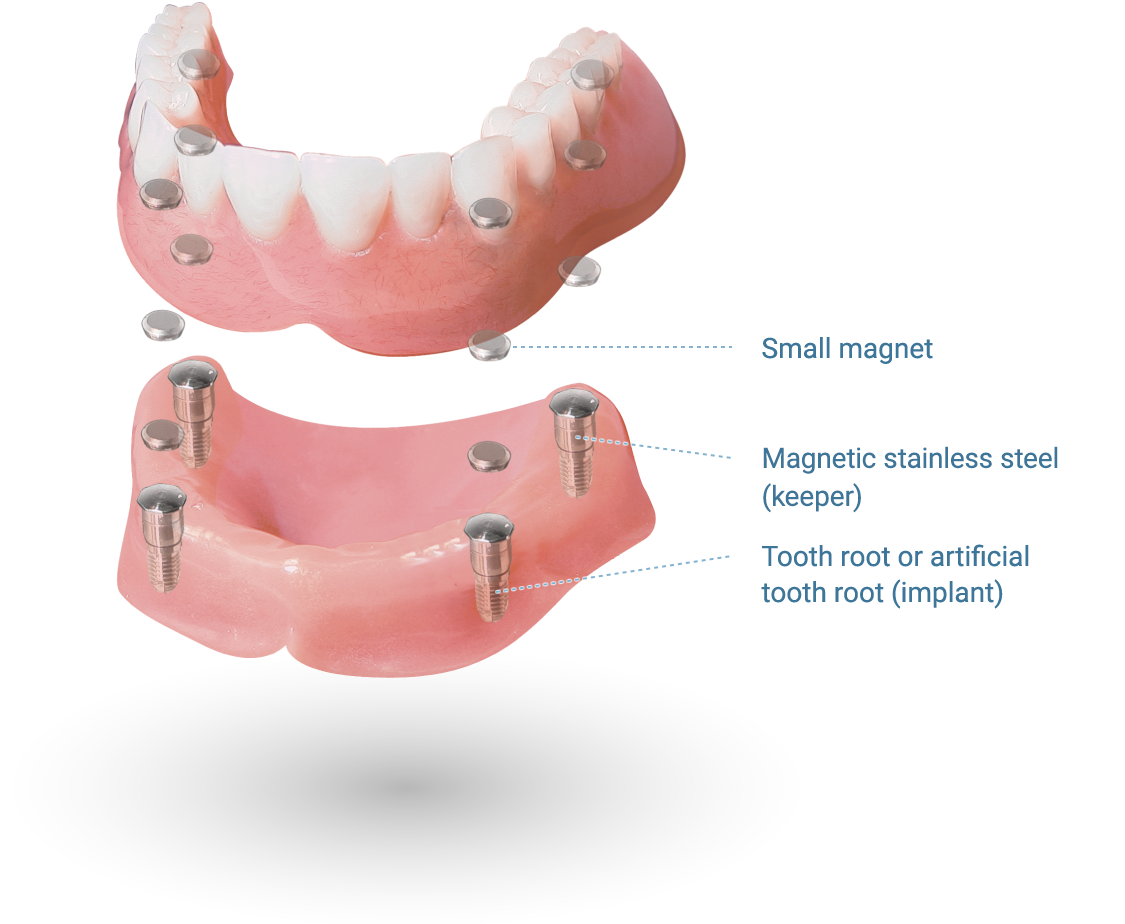 magnetic attachment