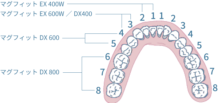 各種天然歯用磁性アタッチメントの適用部位